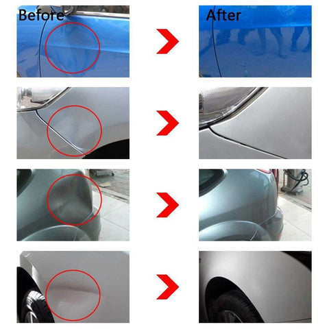 Best Car Dent Remover (Save Thousands Of Dollars In Auto Body Shop Repairs)